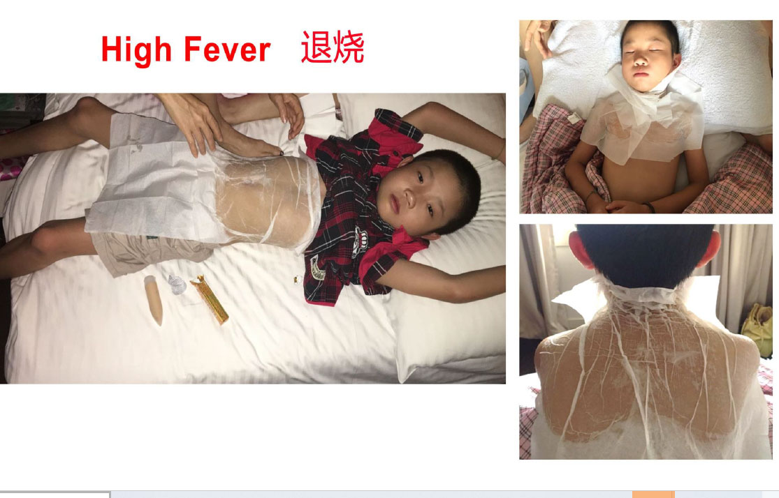 高烧